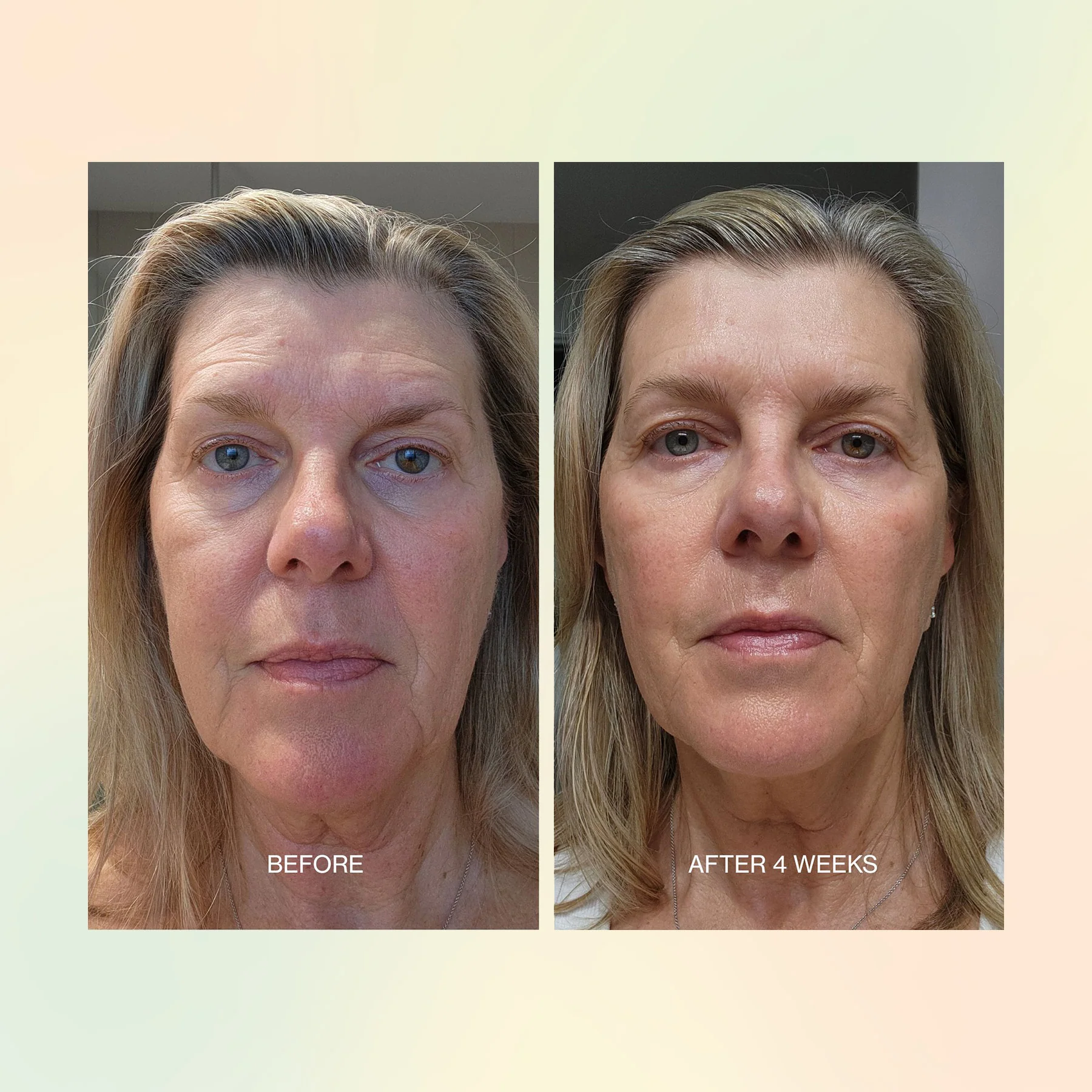 Jojoba Boost Skin Barrier Support - Image 6