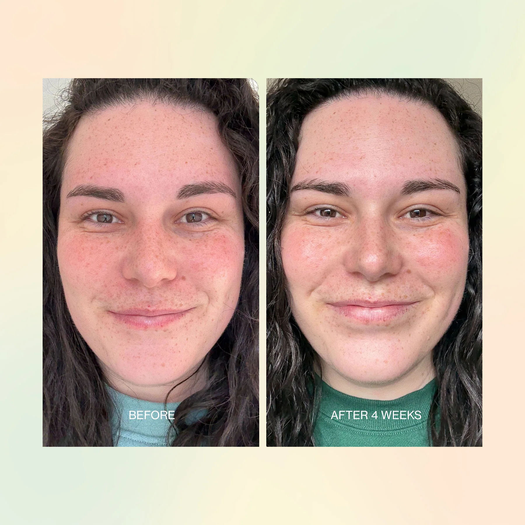 Jojoba Boost Skin Barrier Support - Image 7
