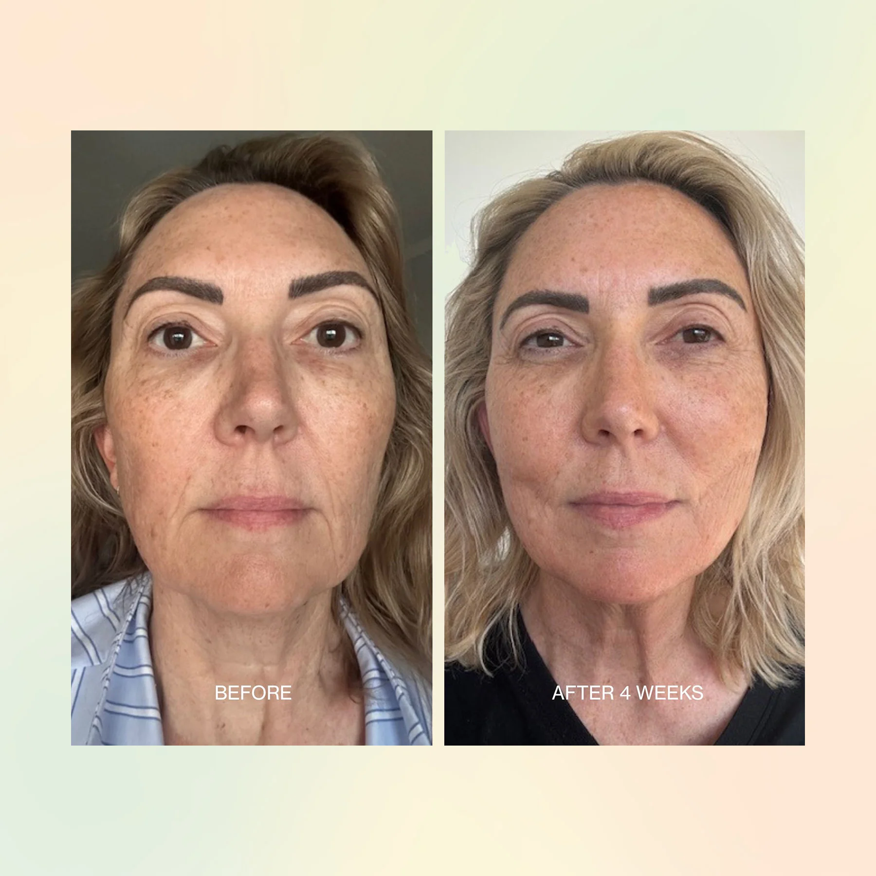 Jojoba Boost Skin Barrier Support - Image 8