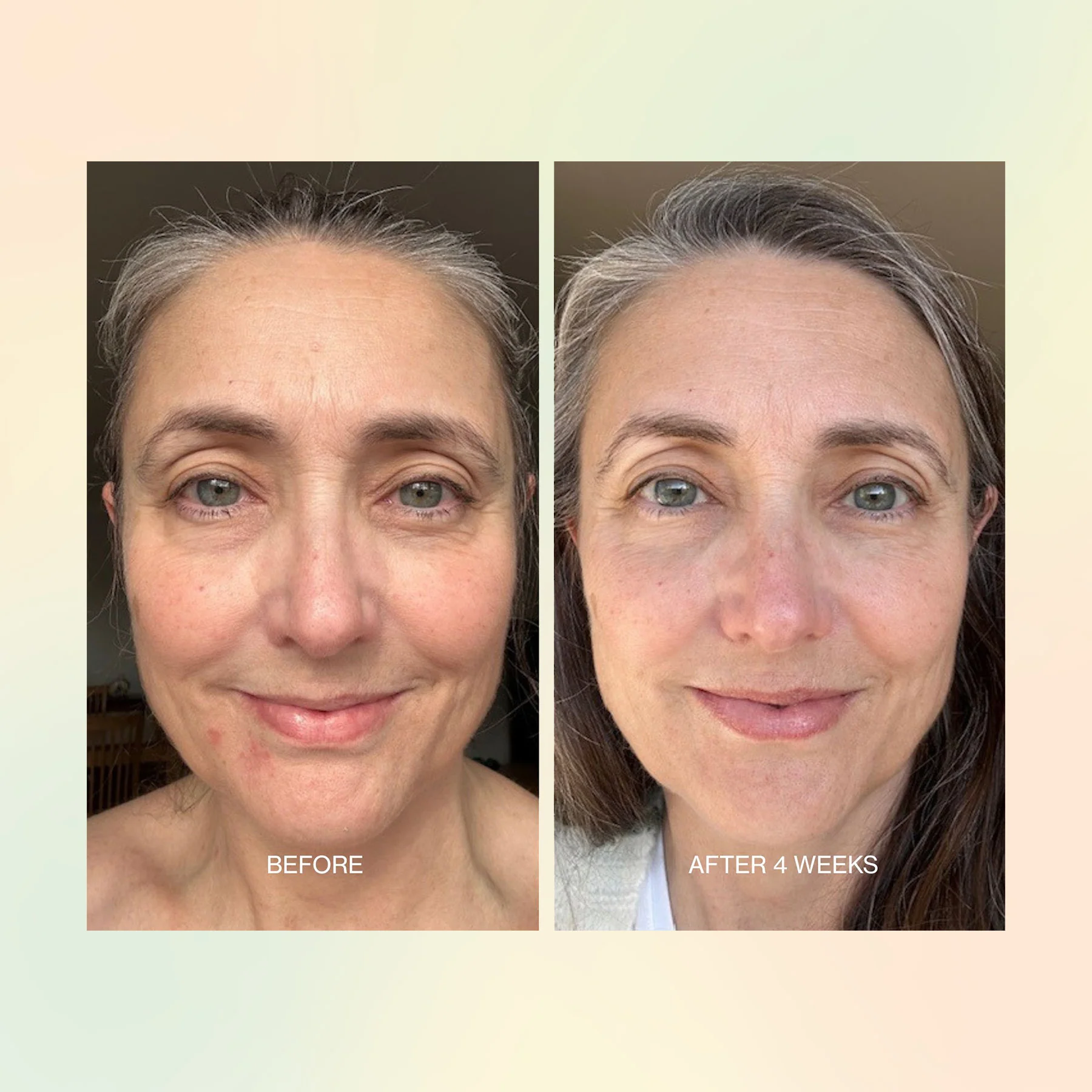 Jojoba Boost Skin Renewal - Image 6