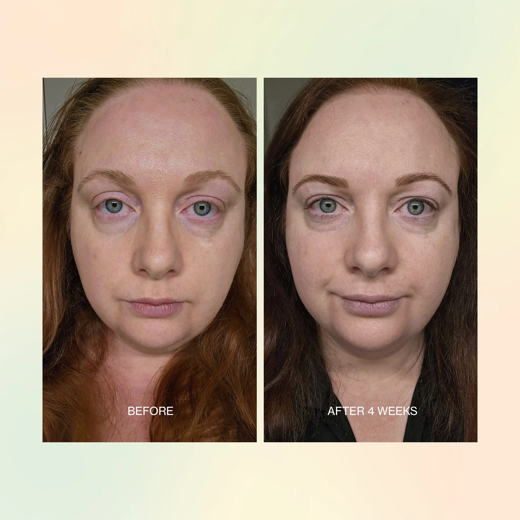 Jojoba Boost Skin Renewal - Image 7