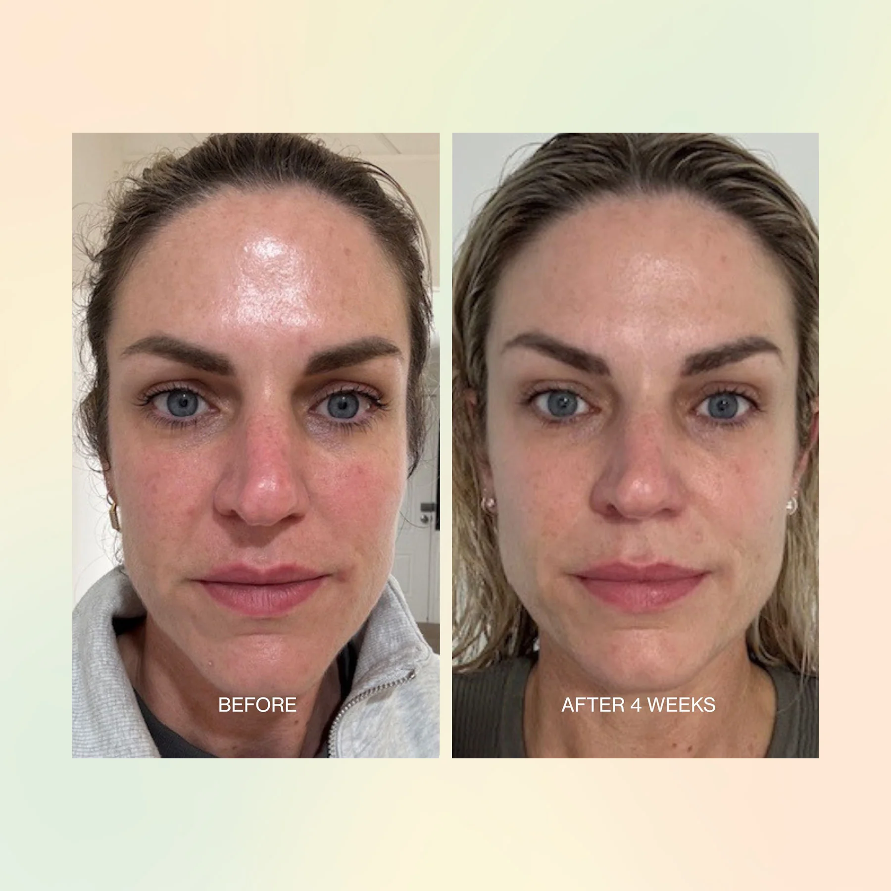Jojoba Boost Skin Renewal - Image 8