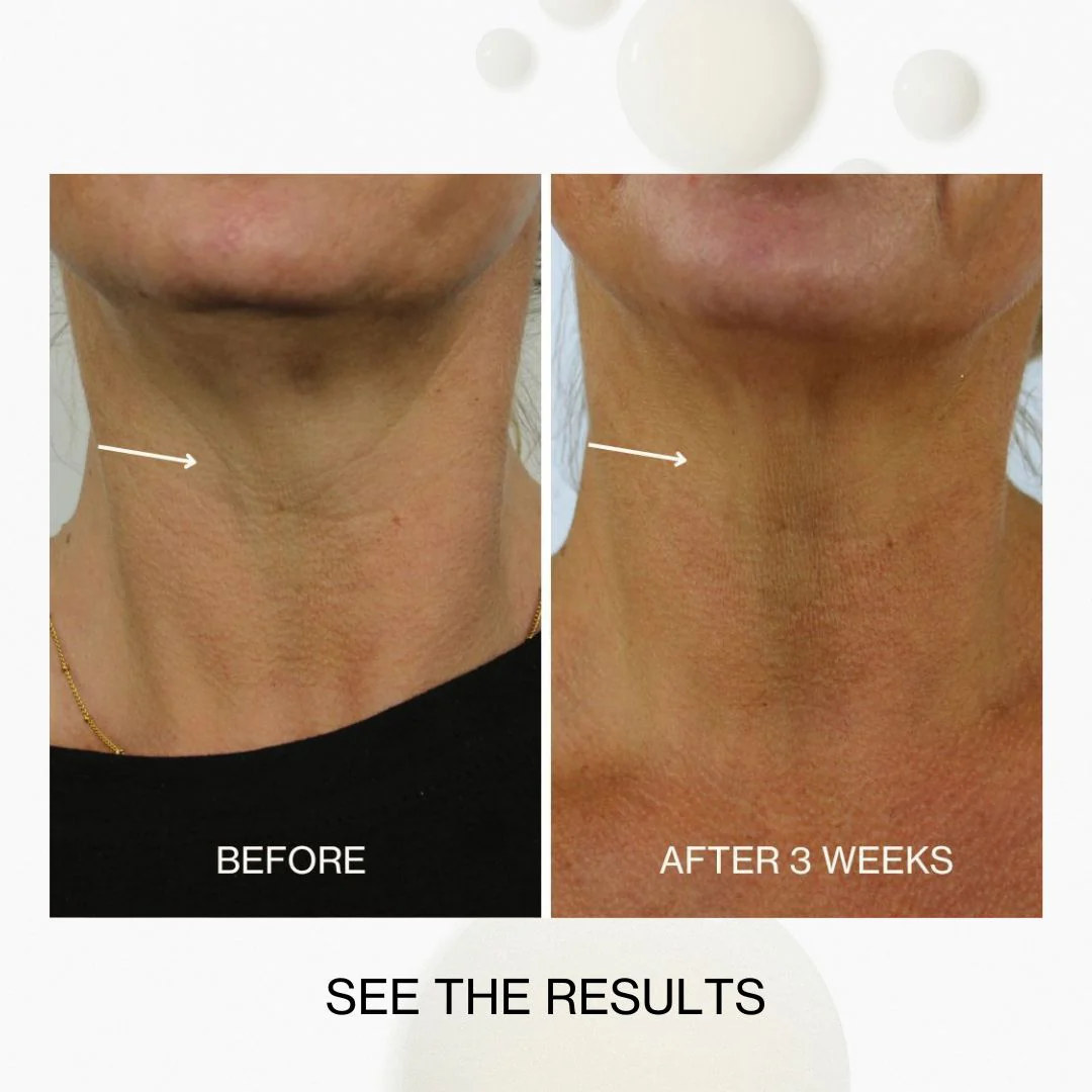 Neck & Décolletage Lifting Concentrate - Image 7