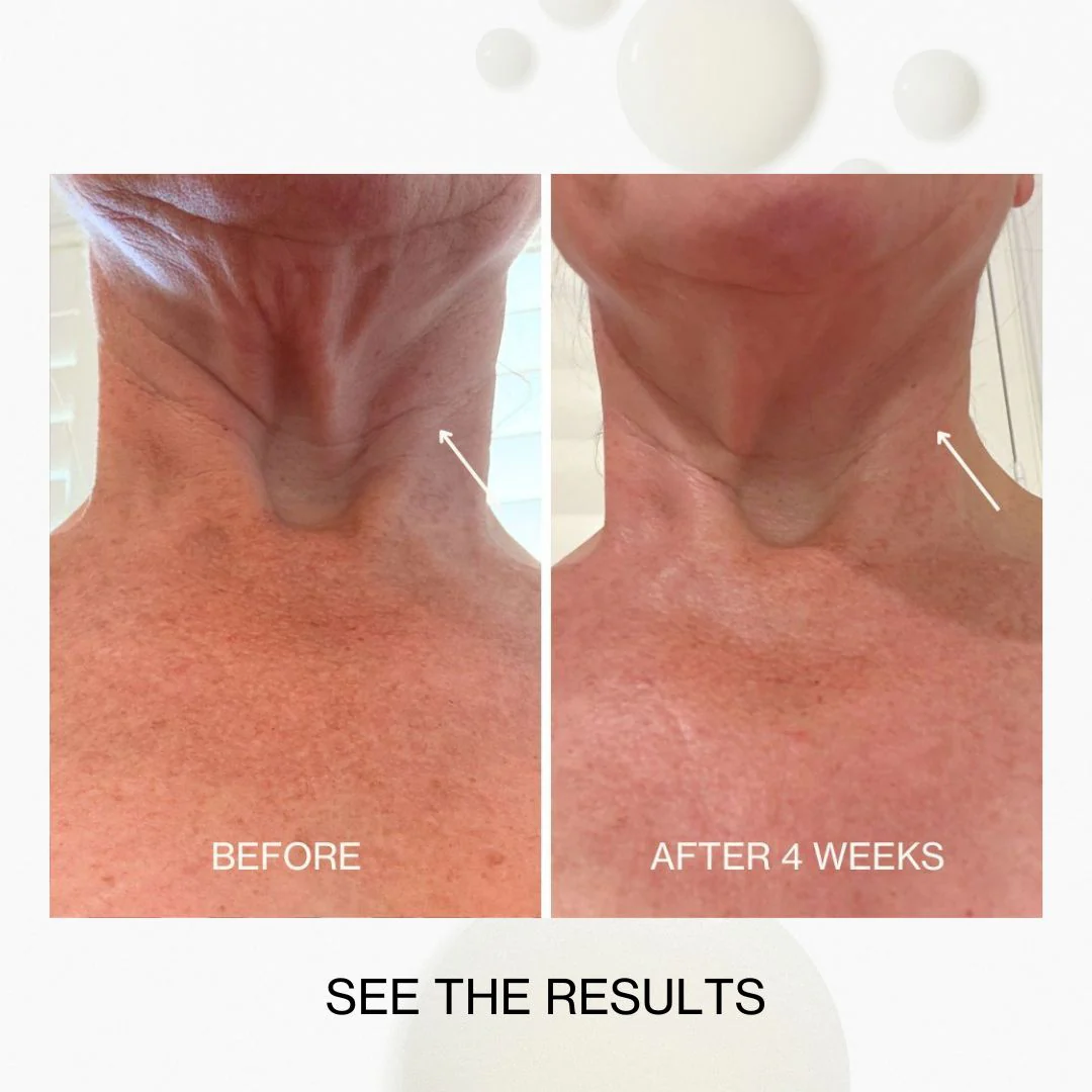 Neck & Décolletage Lifting Concentrate - Image 8