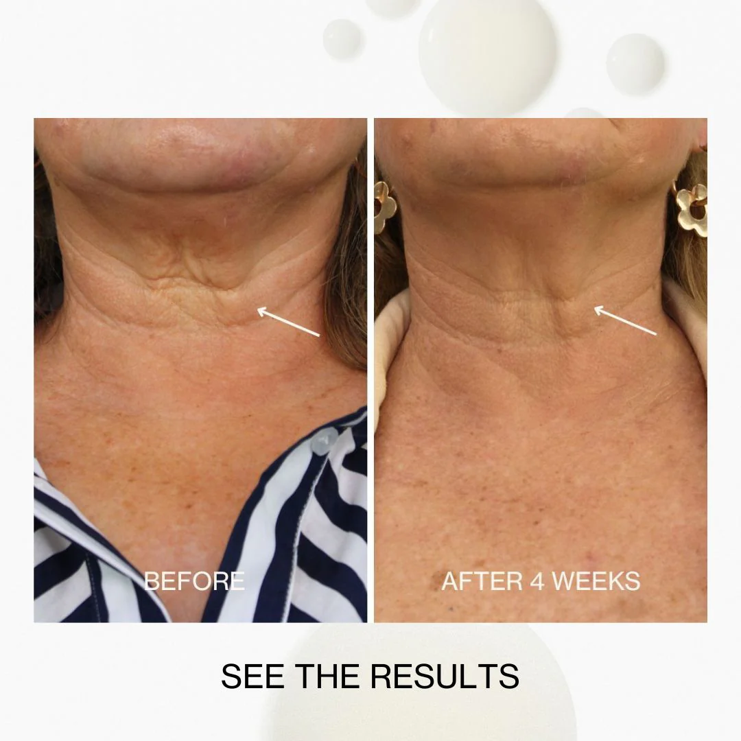 Neck & Décolletage Lifting Concentrate - Image 9